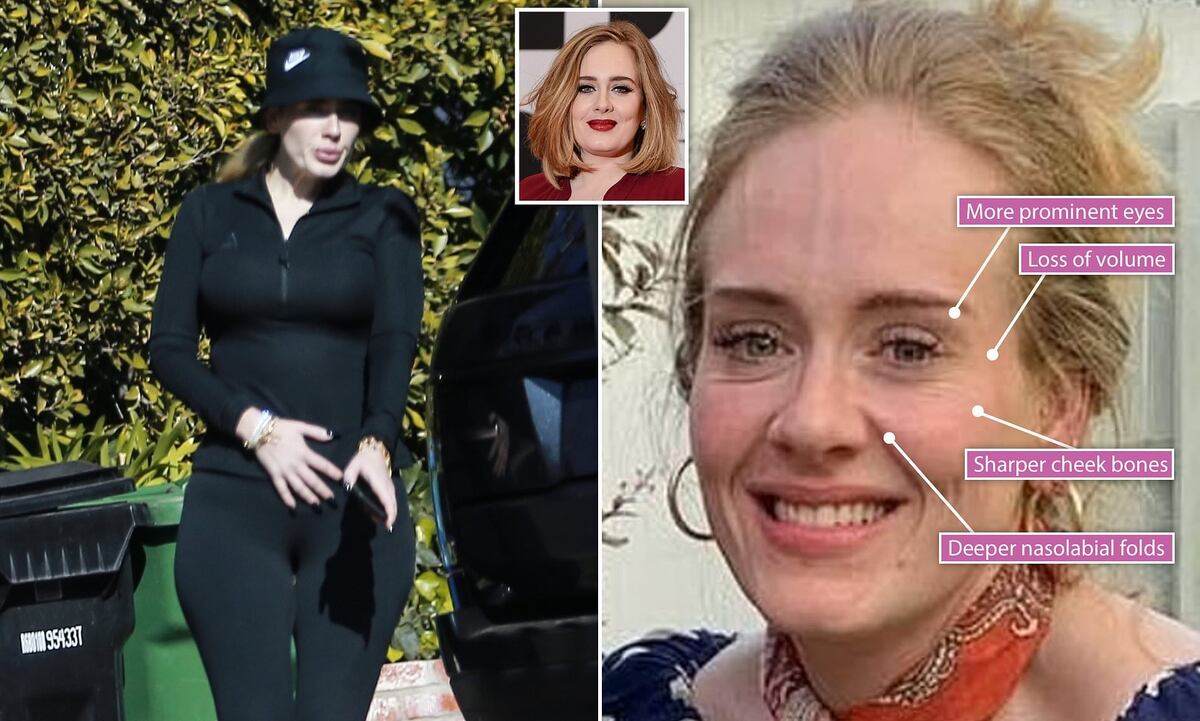 La increíble razón por la que Adele perdió más de 68 kilos y luce tan bien +Fotos 