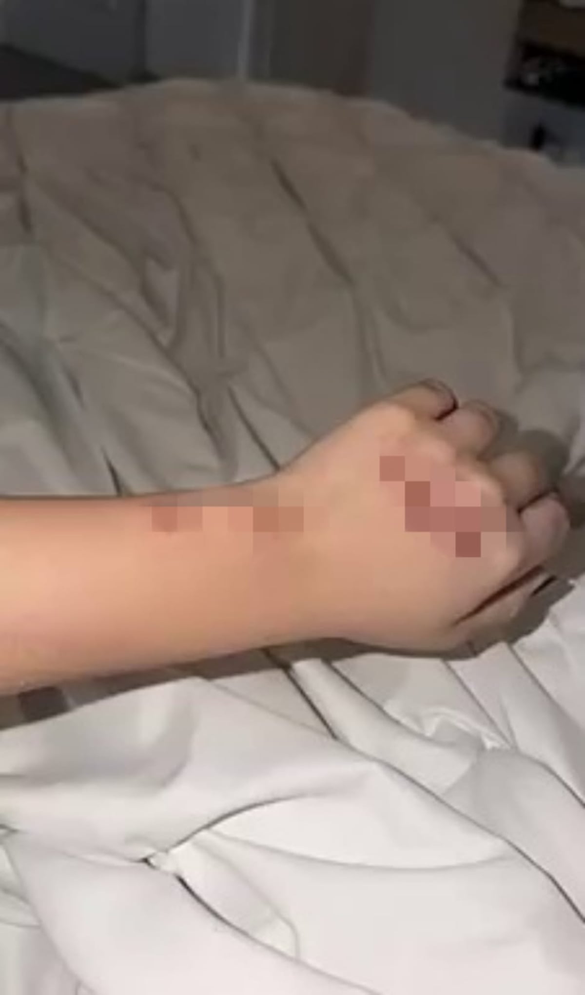 ‘Me hice pelota’: Susy Mouriz sufre fuerte accidente de scooter tras esquivar a un niño