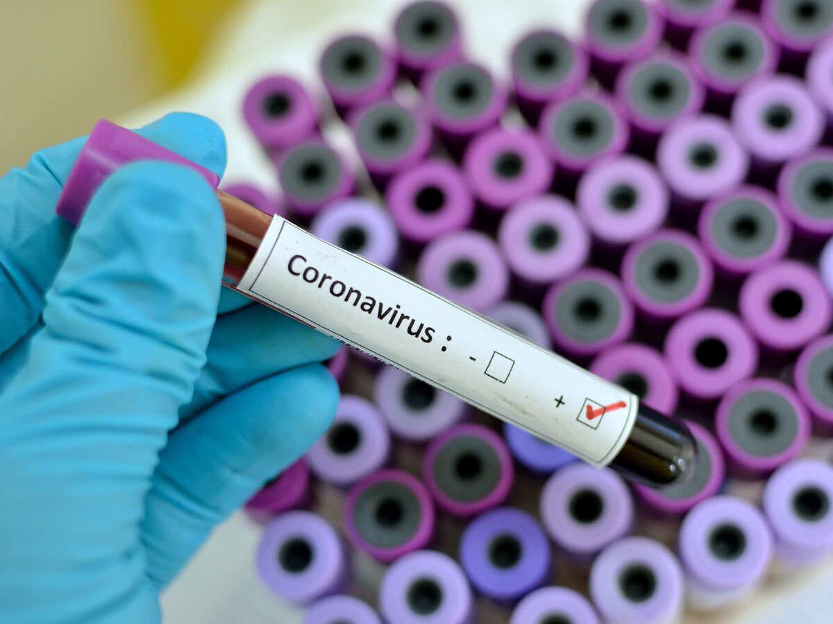 ONUSIDA: Epidemia de coronavirus dificulta tratamiento de seropositivos chinos