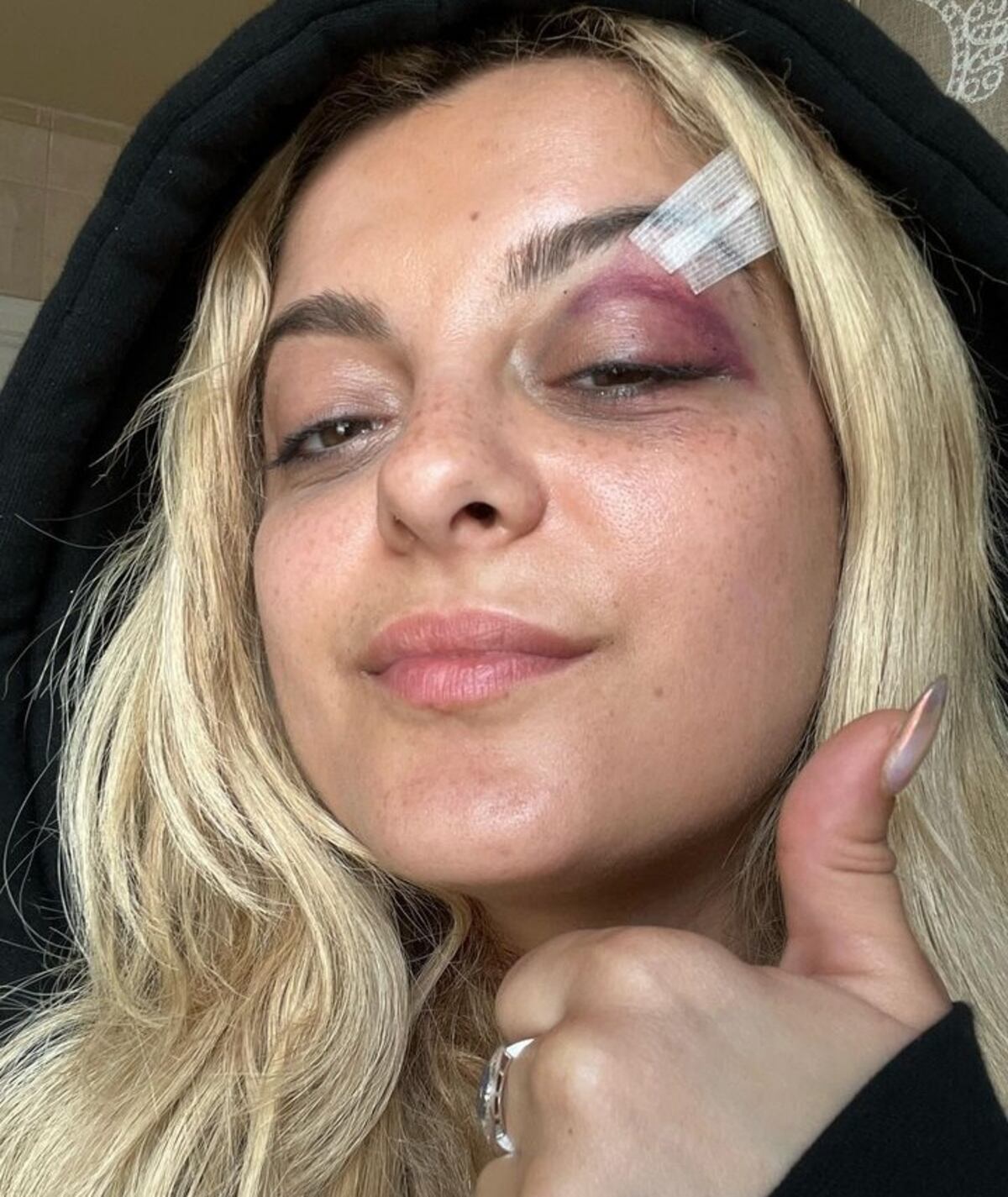 Cantante Bebe Rexha fue herida en la cara con un celular y todo por un reto de Tik Tok