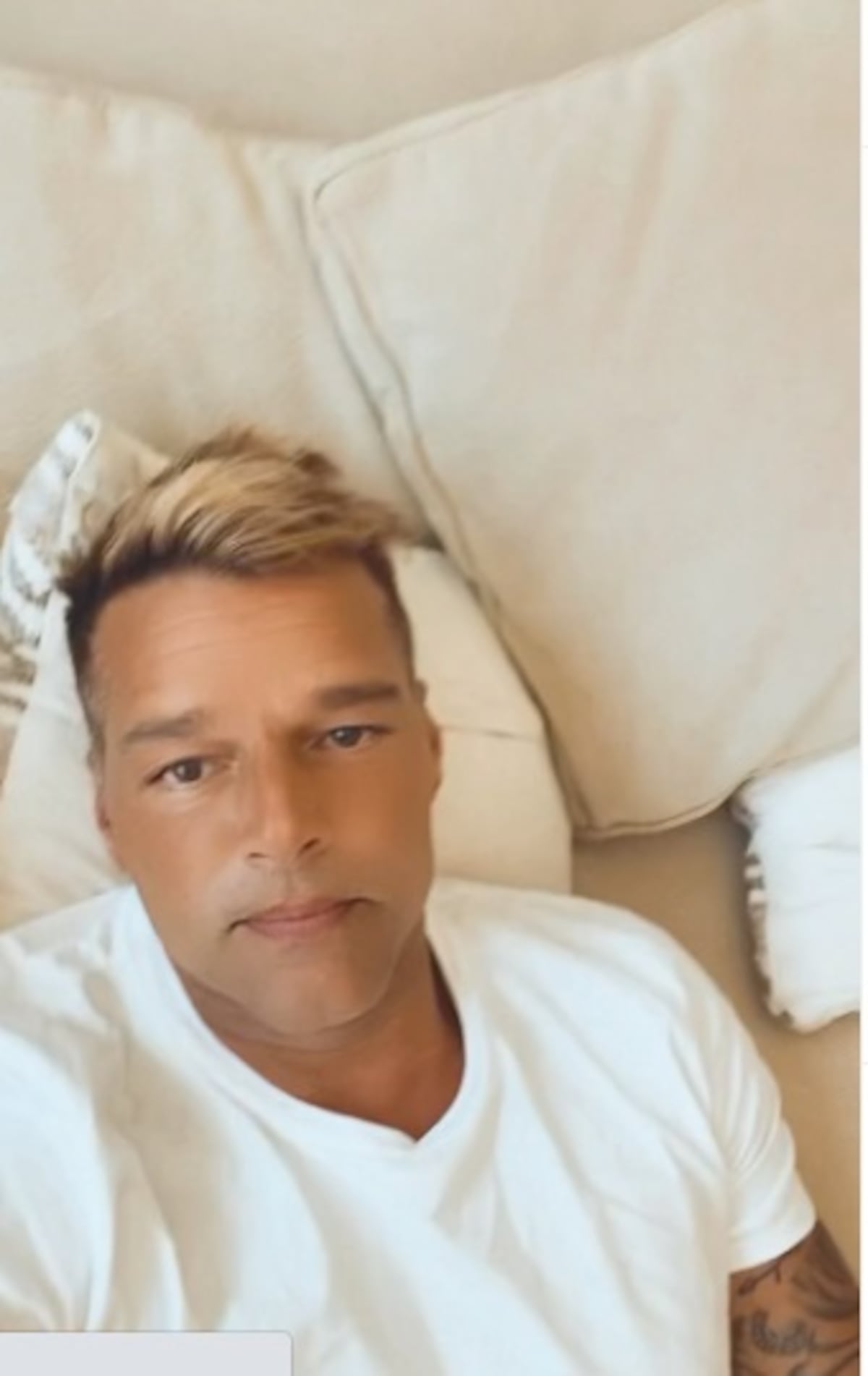 Ricky Martin aparece hinchado y notablemente desfigurado