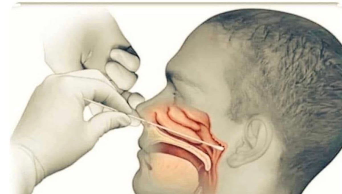 Relato en primera persona. Esto sientes con el hisopado para detectar el COVID-19 +Videos 