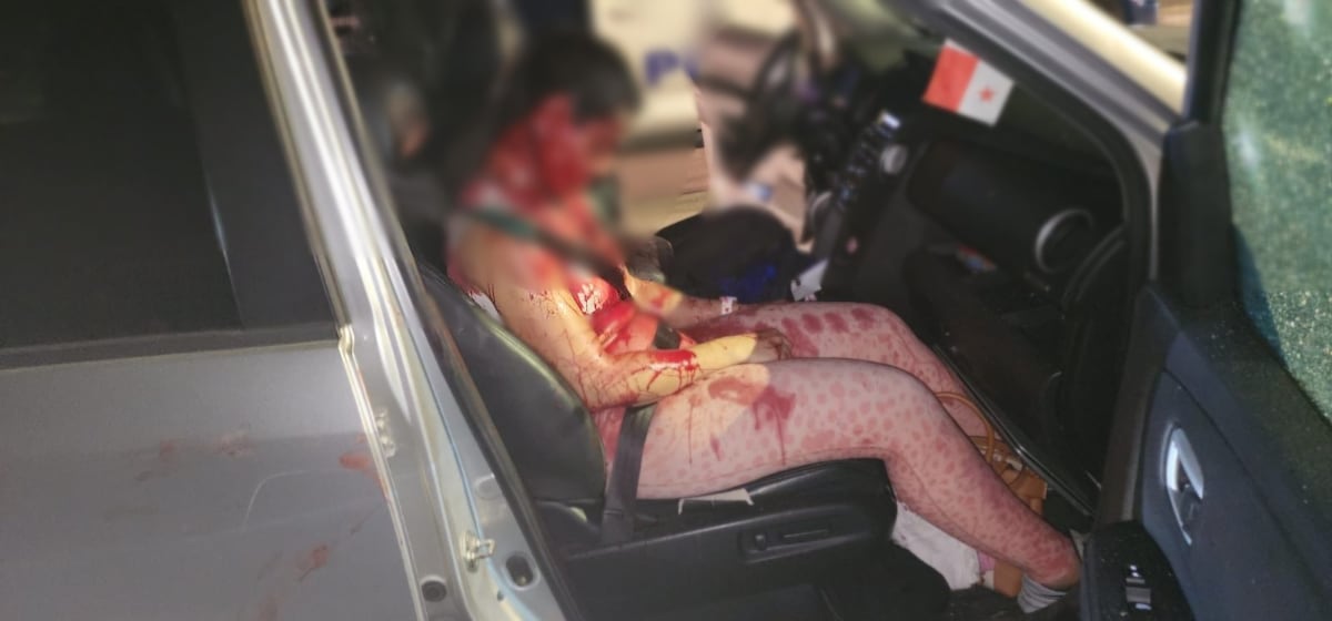 La lluvia mortal de balas que estremeció Costa del Este y acabó con la vida de ella 