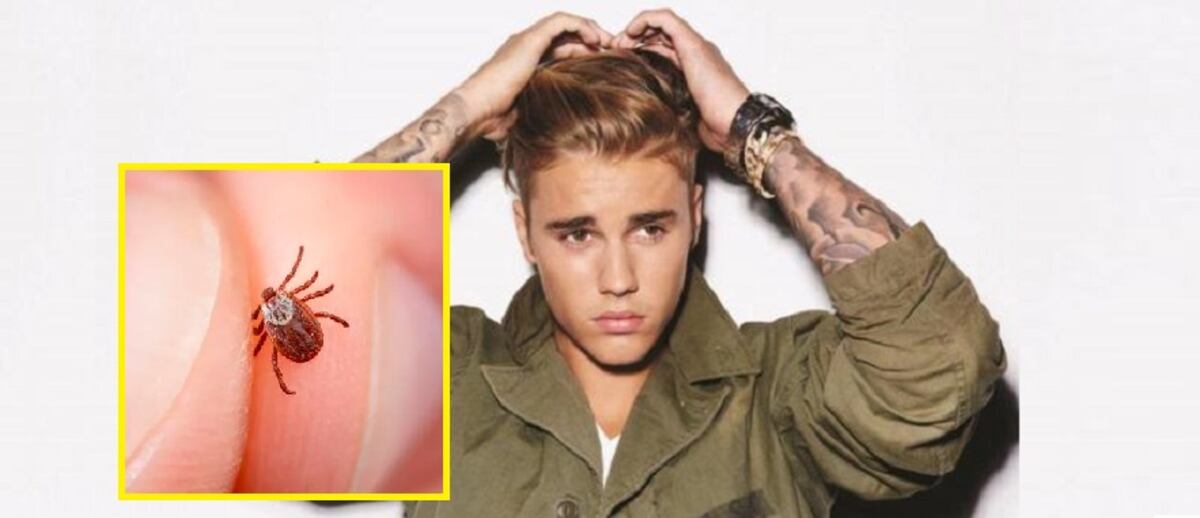 Justin Bieber revela que sufre de Lyme: ¿Qué es esa enfermedad y cómo se transmite?