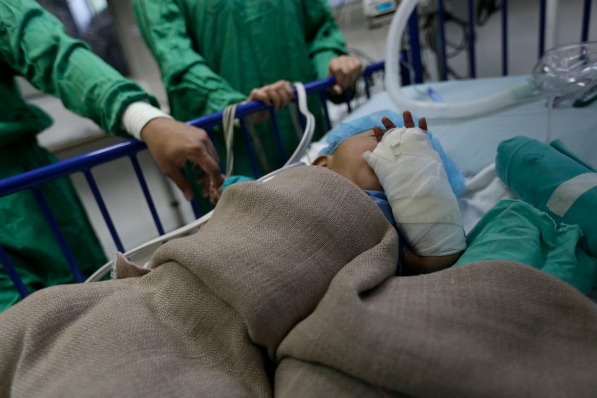 Doctores de la Unidad de Quemados aconsejan a los padres a alejar a los niños de la cocina