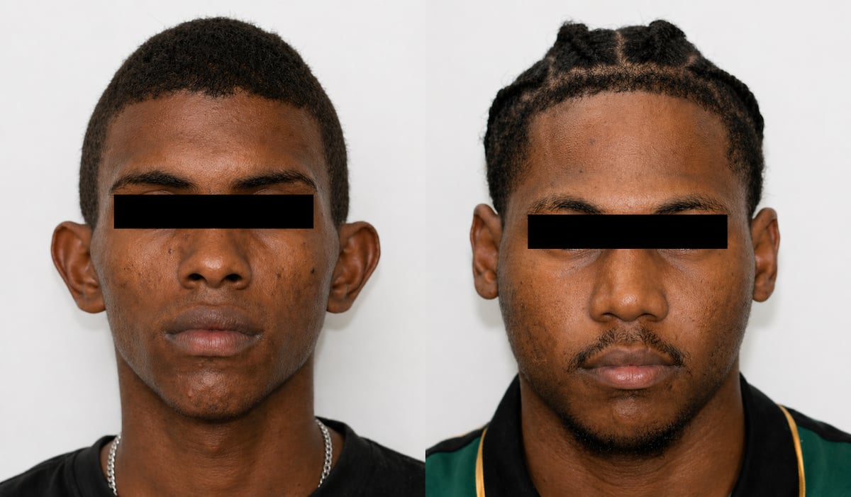 Video revela doble giro en balacera de Colón: revelan identidades tras ataque en Puerto Pilón: ejecutan a Ayarza y uno de los atacantes también muere