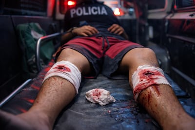 Disparos en Buena Vista dejan herido a Edwin en Buena Vista 