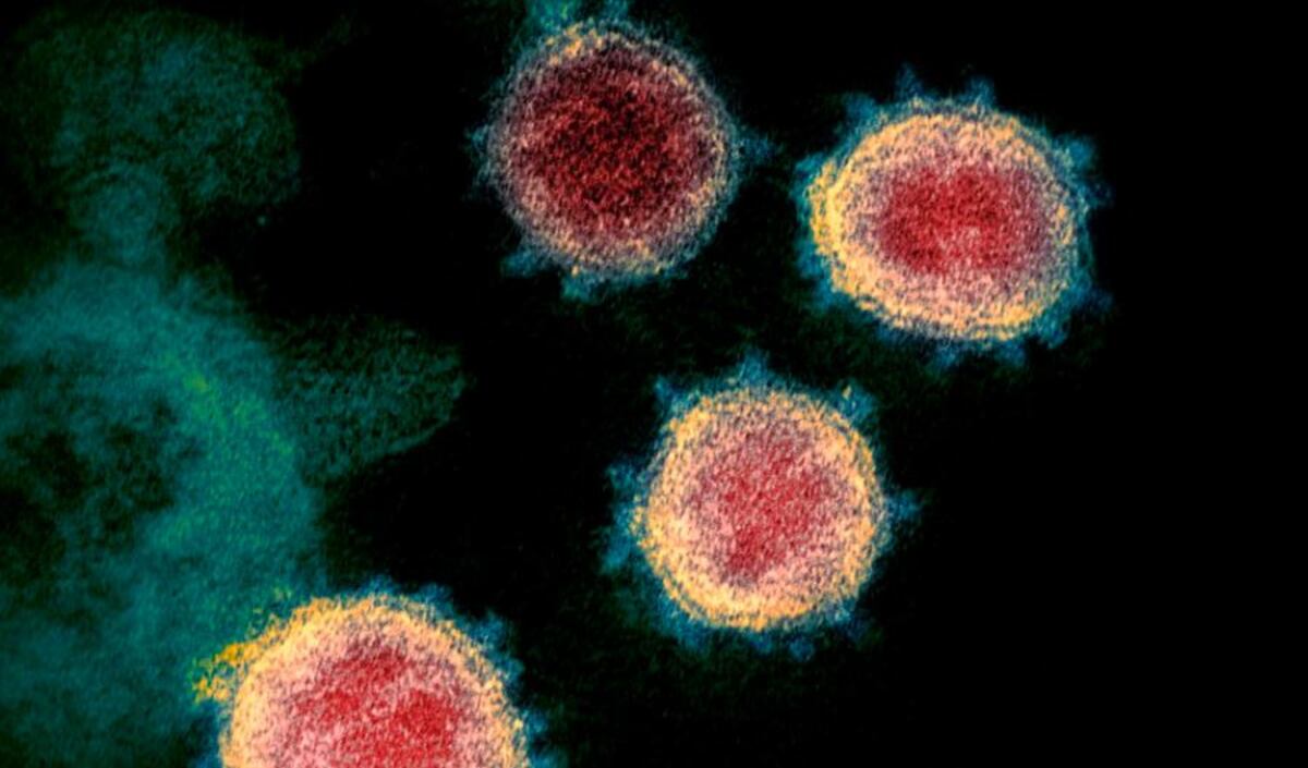 ’Sentí que había ido al infierno y había regresado’, cuenta paciente de coronavirus