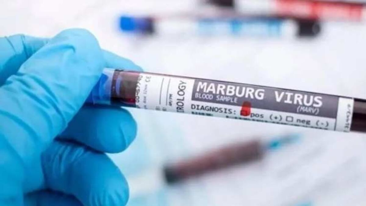 OMS investiga brote del virus de Marburgo, similar al ébola, en Guinea Ecuatorial