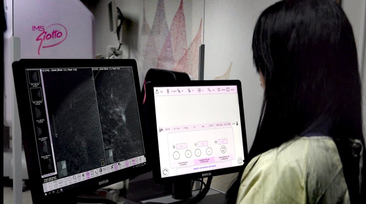 ¡Sin papeleos! Mamografías y pruebas de PSA este fin de semana en la CSS sin cita previa ni orden médica