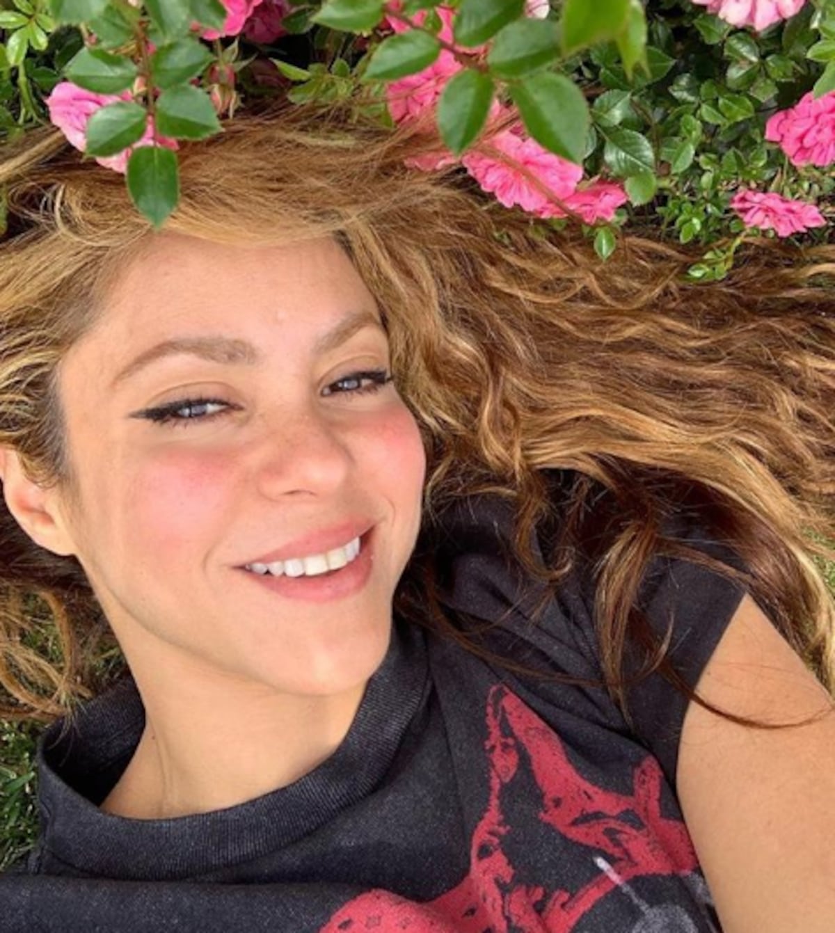 El estrés provoca alopecia a Shakira 