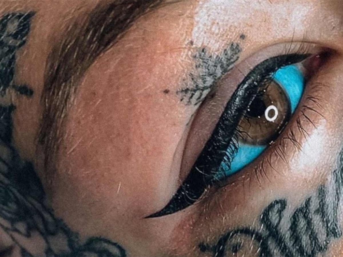 Se tatuó los ojos de azul y quedó ciega