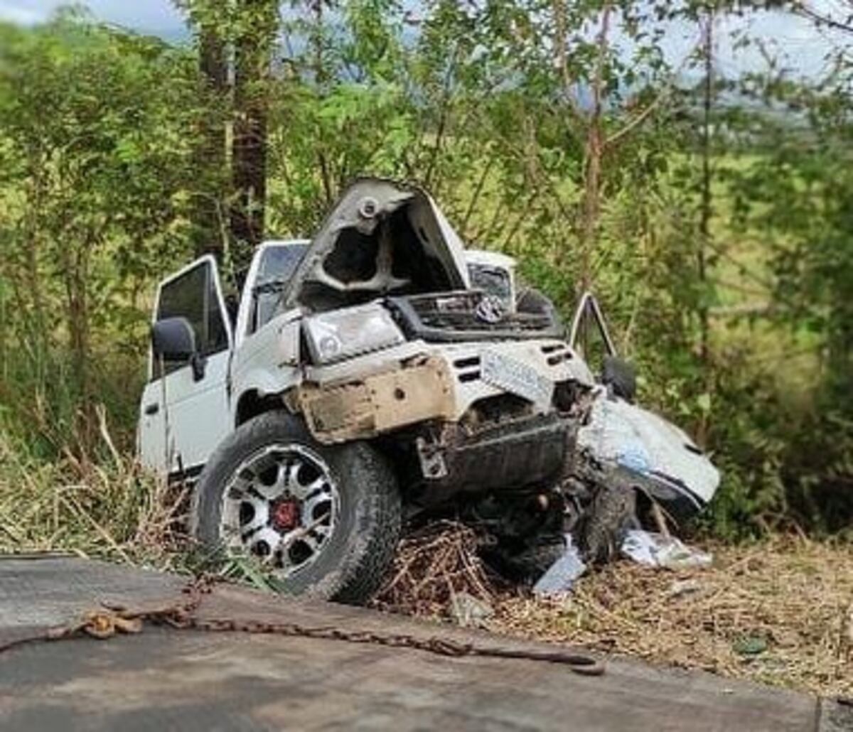 Trabajador chepano que perdió una pierna en accidente necesita pintas de sangre